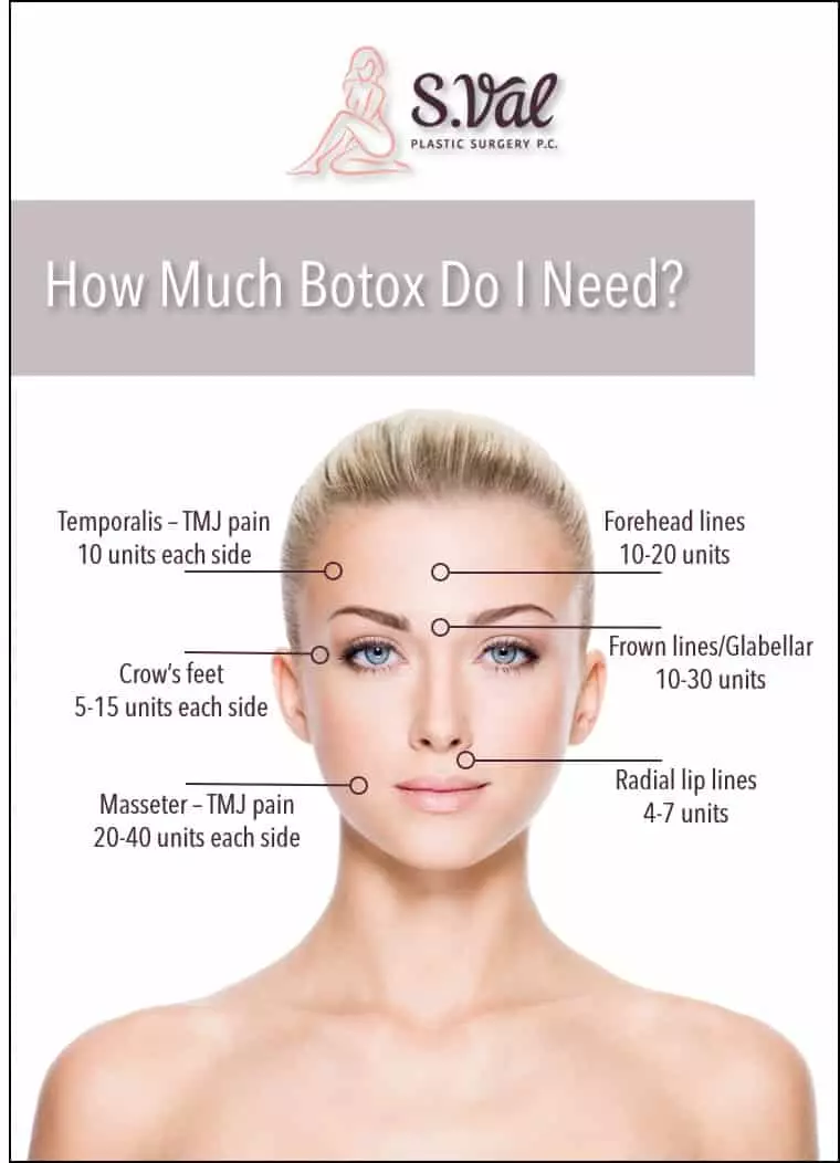 How Much Botox Do I Neeed How Much Botox Do I Neeed